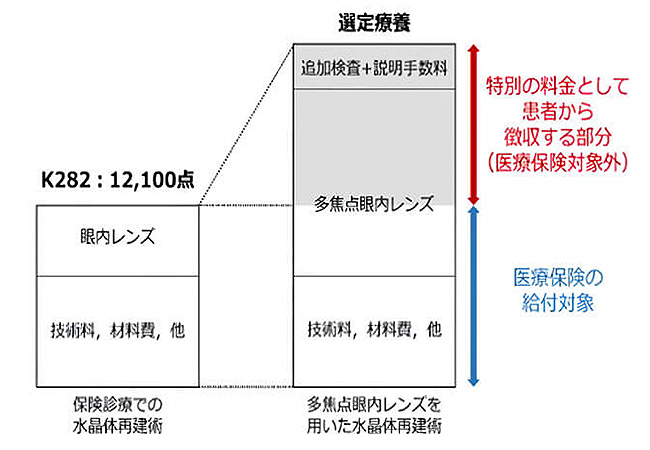 選定療養の図