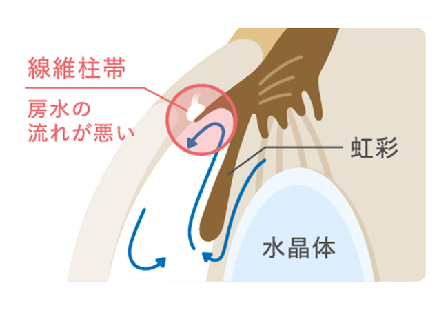 治療前