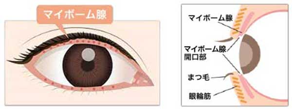 マイボーム線機能不全